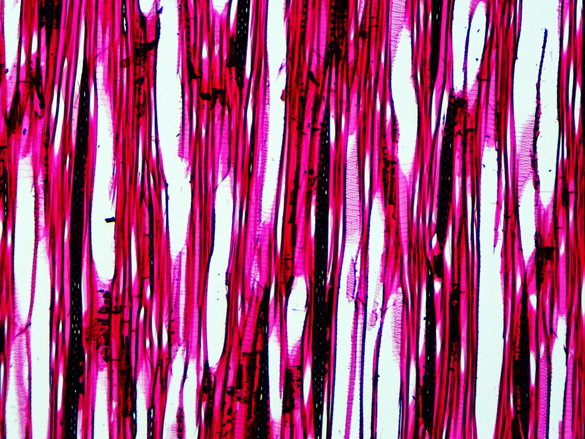 American basswood - Tilia americana This is a tangential section of basswood. The ladder-like parts and sections full of circles are types of intervessel pitting (alternate and scalariform), which is important for water conduction.<br />
<br />
*Microscope slide - tangential section<br />
<figure class="photo"><a href="https://www.jungledragon.com/image/145817/american_basswood_-_tilia_americana.html" title="American basswood - Tilia americana"><img src="https://s3.amazonaws.com/media.jungledragon.com/images/3232/145817_thumb.jpg?AWSAccessKeyId=05GMT0V3GWVNE7GGM1R2&Expires=1759968010&Signature=lJReXDBqaRf3pCLxOuYVTxNpPVk%3D" width="200" height="150" alt="American basswood - Tilia americana This is a stem cross section of the xylem. The line across the middle is the edge of a growth ring.<br />
*Microscope slide - cross section<br />
<br />
https://www.jungledragon.com/image/145816/american_basswood_-_tilia_americana.html American basswood,Tilia americana,microscopy" /></a></figure> American basswood,Tilia americana,basswood,linden,microscopy,tilia
