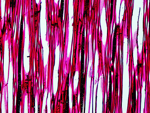 American basswood - Tilia americana This is a tangential section of basswood. The ladder-like parts and sections full of circles are types of intervessel pitting (alternate and scalariform), which is important for water conduction.

*Microscope slide - tangential section
https://www.jungledragon.com/image/145817/american_basswood_-_tilia_americana.html American basswood,Tilia americana,basswood,linden,microscopy,tilia