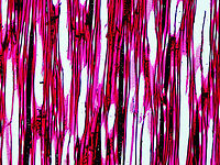 American basswood - Tilia americana This is a tangential section of basswood. The ladder-like parts and sections full of circles are types of intervessel pitting (alternate and scalariform), which is important for water conduction.<br />
<br />
*Microscope slide - tangential section<br />
https://www.jungledragon.com/image/145817/american_basswood_-_tilia_americana.html American basswood,Tilia americana,basswood,linden,microscopy,tilia