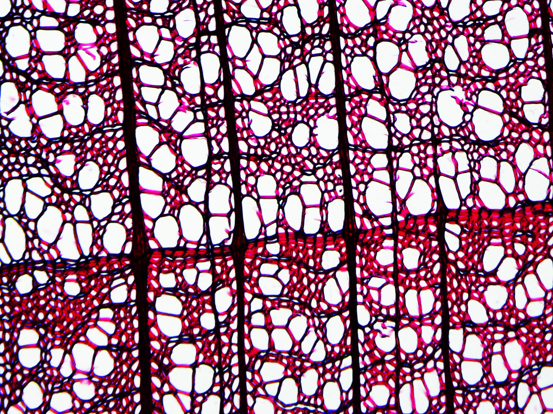American basswood - Tilia americana This is a stem cross section of the xylem. The line across the middle is the edge of a growth ring.<br />
*Microscope slide - cross section<br />
<br />
<figure class="photo"><a href="https://www.jungledragon.com/image/145816/american_basswood_-_tilia_americana.html" title="American basswood - Tilia americana"><img src="https://s3.amazonaws.com/media.jungledragon.com/images/3232/145816_thumb.jpg?AWSAccessKeyId=05GMT0V3GWVNE7GGM1R2&Expires=1759968010&Signature=av4MtJddou7NcFsipUgE7Cg0hr4%3D" width="200" height="150" alt="American basswood - Tilia americana This is a tangential section of basswood. The ladder-like parts and sections full of circles are types of intervessel pitting (alternate and scalariform), which is important for water conduction.<br />
<br />
*Microscope slide - tangential section<br />
https://www.jungledragon.com/image/145817/american_basswood_-_tilia_americana.html American basswood,Tilia americana,basswood,linden,microscopy,tilia" /></a></figure> American basswood,Tilia americana,microscopy