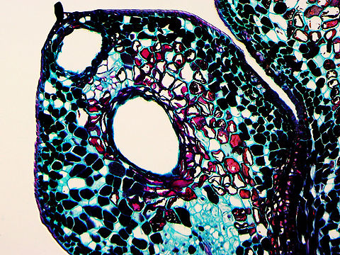 Pine (Pinus sp.) Ovulate Strobilus - Longitudinal Section, 40x This is a longitudinal section of a female (ovulate) pine strobilus (cone). I labeled a few important parts in one of the photos. A female cone has a central cone axis, which bears the scales. Ovuliferous scales have ovules on their upper surface. Ovules develop into seeds after fertilization. The scales protect the seeds during development.

*Microscope slide of longitudinal section, stained
https://www.jungledragon.com/image/145833/pine_pinus_sp._ovulate_strobilus_-_longitudinal_section_10x.html
https://www.jungledragon.com/image/145835/pine_pinus_sp._ovulate_strobilus_-_longitudinal_section_10x.html
https://www.jungledragon.com/image/145834/pine_pinus_sp._ovulate_strobilus_-_longitudinal_section_40x.html cone,microscopy,pine,pinus,strobilus