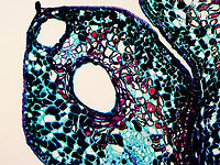 Pine (Pinus sp.) Ovulate Strobilus - Longitudinal Section, 40x This is a longitudinal section of a female (ovulate) pine strobilus (cone). I labeled a few important parts in one of the photos. A female cone has a central cone axis, which bears the scales. Ovuliferous scales have ovules on their upper surface. Ovules develop into seeds after fertilization. The scales protect the seeds during development.<br />
<br />
*Microscope slide of longitudinal section, stained<br />
https://www.jungledragon.com/image/145833/pine_pinus_sp._ovulate_strobilus_-_longitudinal_section_10x.html<br />
https://www.jungledragon.com/image/145835/pine_pinus_sp._ovulate_strobilus_-_longitudinal_section_10x.html<br />
https://www.jungledragon.com/image/145834/pine_pinus_sp._ovulate_strobilus_-_longitudinal_section_40x.html cone,microscopy,pine,pinus,strobilus