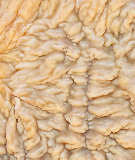 Wrinkled Crust - Phlebia radiata Habitat: Growing on rotting birch logs; mixed forest
https://www.jungledragon.com/image/147433/wrinkled_crust_-_phlebia_radiata.html
https://www.jungledragon.com/image/147435/wrinkled_crust_-_phlebia_radiata.html
https://www.jungledragon.com/image/147434/wrinkled_crust_-_phlebia_radiata.html Fall,Geotagged,Phlebia radiata,United States,Wrinkled crust