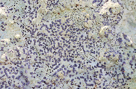 Smoky-eye Boulder Lichen - Porpidia albocaerulescens A common species that decorates the boulders in the forest.

Habitat: They were growing on large, moss-covered rocks throughout a mixed forest.
https://www.jungledragon.com/image/149935/smoky-eye_boulder_lichen_-_porpidia_albocaerulescens.html Fall,Geotagged,Porpidia albocaerulescens,Smokey-eyed Boulder Lichen,United States