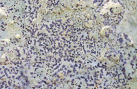 Smoky-eye Boulder Lichen - Porpidia albocaerulescens A common species that decorates the boulders in the forest.<br />
<br />
Habitat: They were growing on large, moss-covered rocks throughout a mixed forest.<br />
https://www.jungledragon.com/image/149935/smoky-eye_boulder_lichen_-_porpidia_albocaerulescens.html Fall,Geotagged,Porpidia albocaerulescens,Smokey-eyed Boulder Lichen,United States