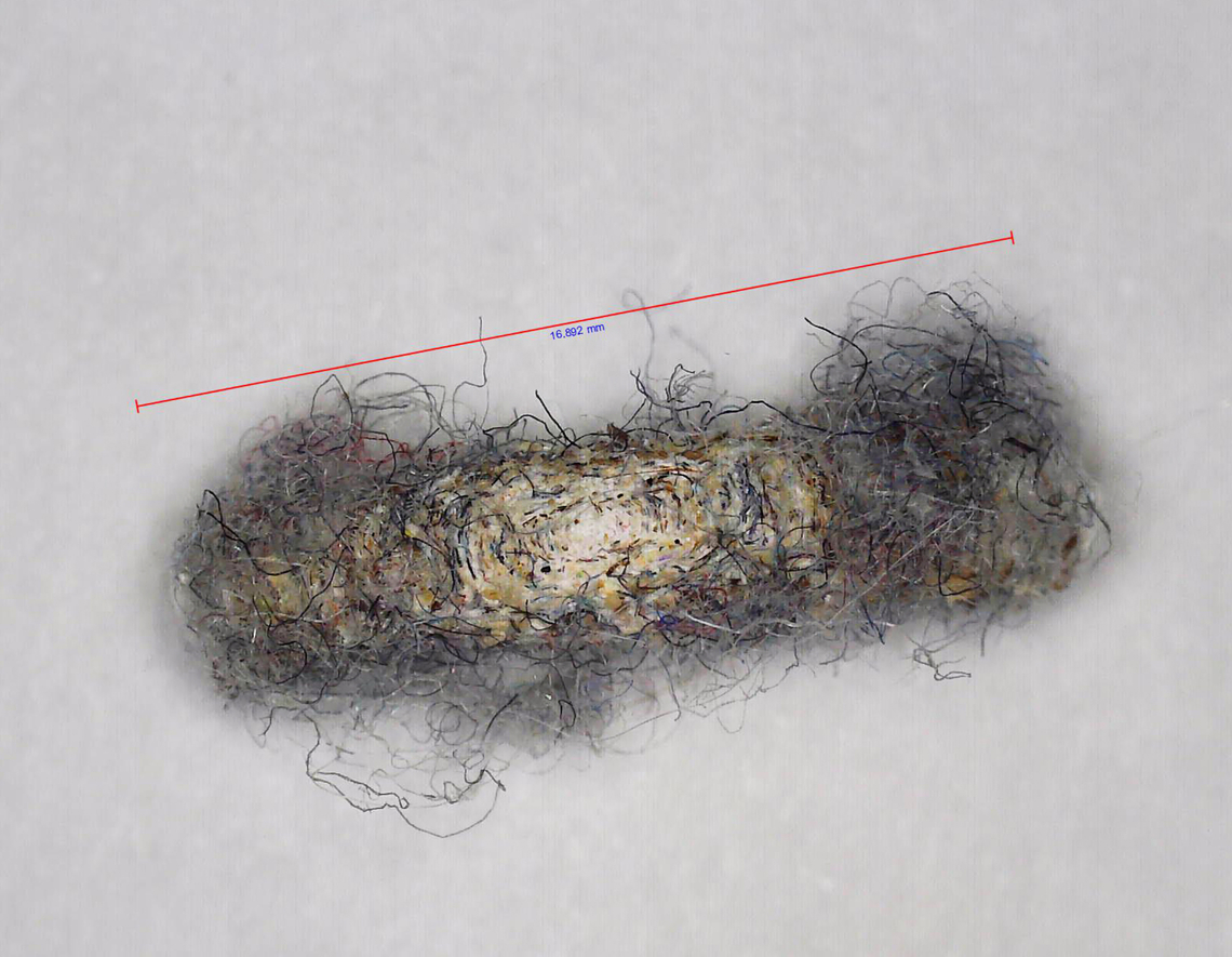 Case-bearing Clothes Moth (Case) - Tinea pellionella Photographed through a microscope.<br />
<figure class="photo"><a href="https://www.jungledragon.com/image/167810/case-bearing_clothes_moth_-_tinea_pellionella.html" title="Case-bearing Clothes Moth - Tinea pellionella"><img src="https://s3.amazonaws.com/media.jungledragon.com/images/3232/167810_thumb.jpg?AWSAccessKeyId=05GMT0V3GWVNE7GGM1R2&Expires=1767225610&Signature=%2FiLxsv8rRk%2F%2BHE3fBjDlsWzmDAs%3D" width="128" height="152" alt="Case-bearing Clothes Moth - Tinea pellionella This stinker was eating my wool hiking socks. I dread finding out how many siblings it has lurking in my closet.<br />
https://www.jungledragon.com/image/167811/case-bearing_clothes_moth_case_-_tinea_pellionella.html Case-bearing clothes moth,Geotagged,Tinea pellionella,United States,case moth,larva,moth,tinea" /></a></figure> Case-bearing clothes moth,Geotagged,Tinea pellionella,United States