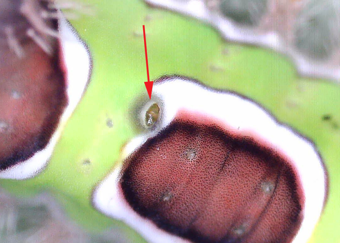 Saddleback Caterpillar - Acharia stimulea Parasitized caterpillars. There were at least 10 caterpillars on this bush. Some were dead with just their shriveled cadavers left, while many had white eggs on them. One had 2 eggs on one of its tubercles AND a hole near the saddle with something moving inside. I suspect the eggs are tachinid eggs. Also, the creature in the hole could be a tachinid larva that hatched and burrowed into the caterpillar. The caterpillar is still alive and I am rearing it to find out what the parasitoids are.<br />
<br />
Video that shows movement (slight) in the hole: <section class="video"><iframe width="448" height="282" src="https://www.youtube-nocookie.com/embed/YZjyby5qSLU?hd=1&autoplay=0&rel=0" frameborder="0" allowfullscreen></iframe></section><br />
<figure class="photo"><a href="https://www.jungledragon.com/image/171244/saddleback_caterpillar_-_acharia_stimulea.html" title="Saddleback Caterpillar - Acharia stimulea"><img src="https://s3.amazonaws.com/media.jungledragon.com/images/3232/171244_thumb.jpg?AWSAccessKeyId=05GMT0V3GWVNE7GGM1R2&Expires=1767225610&Signature=to8lovt5OWLBx3%2BdcJ1W6UYqYKg%3D" width="200" height="146" alt="Saddleback Caterpillar - Acharia stimulea Parasitized caterpillars. There were at least 10 caterpillars on this bush. Some were dead with just their shriveled cadavers left, while many had white eggs on them. One had 2 eggs on one of its tubercles AND a hole near the saddle with something moving inside. I suspect the eggs are tachinid eggs. Also, the creature in the hole could be a tachinid larva that hatched and burrowed into the caterpillar. The caterpillar is still alive and I am rearing it to find out what the parasitoids are.<br />
<br />
Video that shows movement (slight) in the hole: https://www.youtube.com/watch?v=YZjyby5qSLU<br />
<br />
https://www.jungledragon.com/image/171244/saddleback_caterpillar_-_acharia_stimulea.html<br />
https://www.jungledragon.com/image/171243/saddleback_caterpillar_-_acharia_stimulea.html<br />
https://www.jungledragon.com/image/171245/saddleback_caterpillar_-_acharia_stimulea.html<br />
https://www.jungledragon.com/image/171242/saddleback_caterpillar_-_acharia_stimulea.html<br />
https://www.jungledragon.com/image/171246/saddleback_caterpillar_-_acharia_stimulea_parasitized_cadaver.html Acharia stimulea,Geotagged,Saddleback Caterpillar,Summer,United States" /></a></figure><br />
<figure class="photo"><a href="https://www.jungledragon.com/image/171243/saddleback_caterpillar_-_acharia_stimulea.html" title="Saddleback Caterpillar - Acharia stimulea"><img src="https://s3.amazonaws.com/media.jungledragon.com/images/3232/171243_thumb.jpg?AWSAccessKeyId=05GMT0V3GWVNE7GGM1R2&Expires=1767225610&Signature=4gzMhJ9F8HrnJUHuVeKGGCsI9Xw%3D" width="200" height="144" alt="Saddleback Caterpillar - Acharia stimulea Parasitized caterpillars. There were at least 10 caterpillars on this bush. Some were dead with just their shriveled cadavers left, while many had white eggs on them. One had 2 eggs on one of its tubercles AND a hole near the saddle with something moving inside. I suspect the eggs are tachinid eggs. Also, the creature in the hole could be a tachinid larva that hatched and burrowed into the caterpillar. The caterpillar is still alive and I am rearing it to find out what the parasitoids are.<br />
<br />
Video that shows movement (slight) in the hole: https://www.youtube.com/watch?v=YZjyby5qSLU<br />
https://www.jungledragon.com/image/171244/saddleback_caterpillar_-_acharia_stimulea.html<br />
https://www.jungledragon.com/image/171243/saddleback_caterpillar_-_acharia_stimulea.html<br />
https://www.jungledragon.com/image/171245/saddleback_caterpillar_-_acharia_stimulea.html<br />
https://www.jungledragon.com/image/171242/saddleback_caterpillar_-_acharia_stimulea.html<br />
https://www.jungledragon.com/image/171246/saddleback_caterpillar_-_acharia_stimulea_parasitized_cadaver.html Acharia,Acharia stimulea,Geotagged,Saddleback Caterpillar,Summer,United States,caterpillar,larva,parasitized caterpillar,parasitoid,tachinid eggs,tachinidae" /></a></figure><br />
<figure class="photo"><a href="https://www.jungledragon.com/image/171245/saddleback_caterpillar_-_acharia_stimulea.html" title="Saddleback Caterpillar - Acharia stimulea"><img src="https://s3.amazonaws.com/media.jungledragon.com/images/3232/171245_thumb.jpg?AWSAccessKeyId=05GMT0V3GWVNE7GGM1R2&Expires=1767225610&Signature=zYdglGmUTX%2FCZpVrCunY5u2ILBE%3D" width="200" height="140" alt="Saddleback Caterpillar - Acharia stimulea Parasitized caterpillars. There were at least 10 caterpillars on this bush. Some were dead with just their shriveled cadavers left, while many had white eggs on them. One had 2 eggs on one of its tubercles AND a hole near the saddle with something moving inside. I suspect the eggs are tachinid eggs. Also, the creature in the hole could be a tachinid larva that hatched and burrowed into the caterpillar. The caterpillar is still alive and I am rearing it to find out what the parasitoids are.<br />
<br />
Video that shows movement (slight) in the hole: https://www.youtube.com/watch?v=YZjyby5qSLU<br />
https://www.jungledragon.com/image/171244/saddleback_caterpillar_-_acharia_stimulea.html<br />
https://www.jungledragon.com/image/171243/saddleback_caterpillar_-_acharia_stimulea.html<br />
https://www.jungledragon.com/image/171245/saddleback_caterpillar_-_acharia_stimulea.html<br />
https://www.jungledragon.com/image/171242/saddleback_caterpillar_-_acharia_stimulea.html<br />
https://www.jungledragon.com/image/171246/saddleback_caterpillar_-_acharia_stimulea_parasitized_cadaver.html Acharia stimulea,Geotagged,Saddleback Caterpillar,Summer,United States" /></a></figure><br />
<figure class="photo"><a href="https://www.jungledragon.com/image/171242/saddleback_caterpillar_-_acharia_stimulea.html" title="Saddleback Caterpillar - Acharia stimulea"><img src="https://s3.amazonaws.com/media.jungledragon.com/images/3232/171242_thumb.jpg?AWSAccessKeyId=05GMT0V3GWVNE7GGM1R2&Expires=1767225610&Signature=gxrUHDqfiQpPxbkYhJvlzCt16uE%3D" width="200" height="144" alt="Saddleback Caterpillar - Acharia stimulea Parasitized caterpillars. There were at least 10 caterpillars on this bush. Some were dead with just their shriveled cadavers left, while many had white eggs on them. One had 2 eggs on one of its tubercles AND a hole near the saddle with something moving inside. I suspect the eggs are tachinid eggs. Also, the creature in the hole could be a tachinid larva that hatched and burrowed into the caterpillar. The caterpillar is still alive and I am rearing it to find out what the parasitoids are.<br />
<br />
Video that shows movement (slight) in the hole: https://www.youtube.com/watch?v=YZjyby5qSLU<br />
https://www.jungledragon.com/image/171244/saddleback_caterpillar_-_acharia_stimulea.html<br />
https://www.jungledragon.com/image/171243/saddleback_caterpillar_-_acharia_stimulea.html<br />
https://www.jungledragon.com/image/171245/saddleback_caterpillar_-_acharia_stimulea.html<br />
https://www.jungledragon.com/image/171242/saddleback_caterpillar_-_acharia_stimulea.html<br />
https://www.jungledragon.com/image/171246/saddleback_caterpillar_-_acharia_stimulea_parasitized_cadaver.html Acharia stimulea,Geotagged,Saddleback Caterpillar,United States" /></a></figure><br />
<figure class="photo"><a href="https://www.jungledragon.com/image/171246/saddleback_caterpillar_-_acharia_stimulea_parasitized_cadaver.html" title="Saddleback Caterpillar - Acharia stimulea (Parasitized Cadaver)"><img src="https://s3.amazonaws.com/media.jungledragon.com/images/3232/171246_thumb.jpg?AWSAccessKeyId=05GMT0V3GWVNE7GGM1R2&Expires=1767225610&Signature=03m1%2FiCI%2BGnaJxBsqlJX5zas0G0%3D" width="200" height="152" alt="Saddleback Caterpillar - Acharia stimulea (Parasitized Cadaver) Parasitized caterpillars. There were at least 10 caterpillars on this bush. Some were dead with just their shriveled cadavers left, while many had white eggs on them. One had 2 eggs on one of its tubercles AND a hole near the saddle with something moving inside. I suspect the eggs are tachinid eggs. Also, the creature in the hole could be a tachinid larva that hatched and burrowed into the caterpillar. The caterpillar is still alive and I am rearing it to find out what the parasitoids are.<br />
<br />
Video that shows movement (slight) in the hole: https://www.youtube.com/watch?v=YZjyby5qSLU<br />
https://www.jungledragon.com/image/171244/saddleback_caterpillar_-_acharia_stimulea.html<br />
https://www.jungledragon.com/image/171243/saddleback_caterpillar_-_acharia_stimulea.html<br />
https://www.jungledragon.com/image/171245/saddleback_caterpillar_-_acharia_stimulea.html<br />
https://www.jungledragon.com/image/171242/saddleback_caterpillar_-_acharia_stimulea.html<br />
https://www.jungledragon.com/image/171246/saddleback_caterpillar_-_acharia_stimulea_parasitized_cadaver.html Acharia stimulea,Geotagged,Saddleback Caterpillar,Summer,United States" /></a></figure> Acharia stimulea,Geotagged,Saddleback Caterpillar,United States