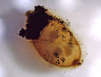 Leech Egg Case (Removed from Leaf) I found this egg case stuck to a leaf in a shallow pond. I took this photo with a digital scope.<br />
<br />
Habitat: Freshwater, woodland pond<br />
https://www.jungledragon.com/image/93390/egg_case.html<br />
https://www.jungledragon.com/image/93392/egg_case.html Geotagged,United States,egg case,leech egg case