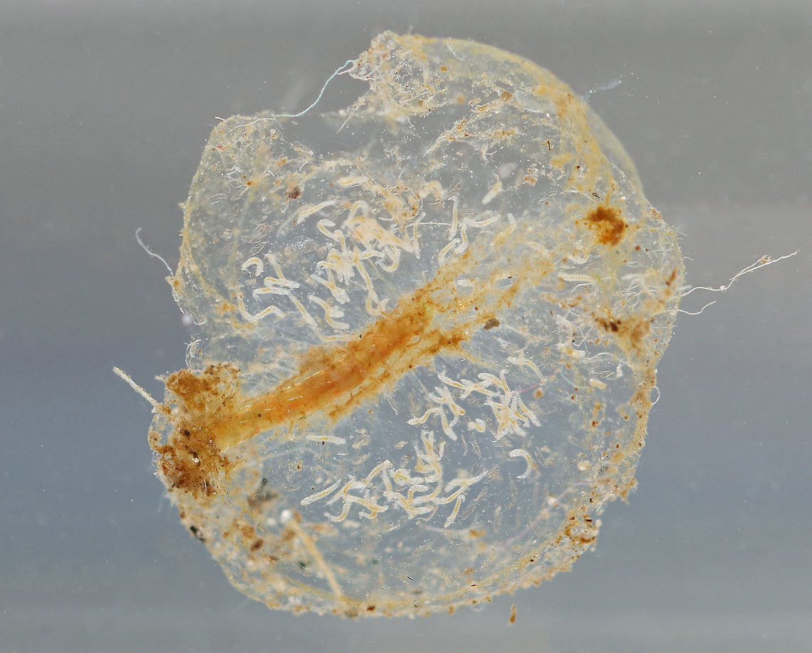 Midge (Chironomidae) Larva with Midge (Tanypodinae) Larvae Well. This is weird and I wish I had better photos, but this was super hard to photograph. <br />
<br />
What you are looking at is a gelatinous blob with tiny midge eggs (Tanypodinae). In the center of the blob is a large Chironomid larva that appeared to have gotten inside the blob somehow and made itself a tunnel. It was eating the goo or the eggs, I'm not sure. <br />
<br />
***This photo was taken 24 hours after collection. The tiny midge eggs had hatched and the large larva had grown a bit. The gelatinous matrix was beginning to break down.<br />
<br />
Habitat: Collected in a pond and photographed at home.<br />
<br />
Video on Day 1: <section class="video"><iframe width="448" height="252" src="https://player.vimeo.com/video/430465270?title=0&byline=0&portrait=0" frameborder="0"></iframe></section><br />
<br />
Video after 48 hours: <section class="video"><iframe width="448" height="252" src="https://player.vimeo.com/video/430466114?title=0&byline=0&portrait=0" frameborder="0"></iframe></section><br />
<br />
Photo from Day 1 (Day of Collection):<br />
<figure class="photo"><a href="https://www.jungledragon.com/image/95894/midge_chironomidae_larva_with_midge_tanypodinae_eggs.html" title="Midge (Chironomidae) Larva with Midge (Tanypodinae) Eggs"><img src="https://s3.amazonaws.com/media.jungledragon.com/images/3232/95894_thumb.jpg?AWSAccessKeyId=05GMT0V3GWVNE7GGM1R2&Expires=1765411210&Signature=5bsdvywz36zremruouX24OzDrok%3D" width="200" height="176" alt="Midge (Chironomidae) Larva with Midge (Tanypodinae) Eggs Well. This is weird and I wish I had better photos, but this was super hard to photograph. <br />
<br />
What you are looking at is a gelatinous blob with tiny midge eggs (Tanypodinae). In the center of the blob is a large Chironomid larva that appeared to have gotten inside the blob somehow and made itself a tunnel. It was eating the goo or the eggs, I'm not sure. <br />
<br />
This photo was taken on day 1  - the day of collection.<br />
<br />
Habitat: Collected in a pond and photographed at home.<br />
<br />
Video on Day 1: https://vimeo.com/430465270<br />
<br />
Video after 48 hours: https://vimeo.com/430466114<br />
<br />
Photo from 24 hours after collection:<br />
https://www.jungledragon.com/image/95895/midge_chironomidae_larva_with_midge_tanypodinae_larvae.html<br />
<br />
Photo from 48 hours after collection:<br />
https://www.jungledragon.com/image/95896/midge_chironomidae_larva_with_midge_tanypodinae_larvae.html Chironomidae,Geotagged,Tanypodinae,United States,eggs,larvae,midge eggs,midge larvae,non-biting midge" /></a></figure><br />
<br />
Photo from 48 hours after collection:<br />
<figure class="photo"><a href="https://www.jungledragon.com/image/95896/midge_chironomidae_larva_with_midge_tanypodinae_larvae.html" title="Midge (Chironomidae) Larva with Midge (Tanypodinae) Larvae"><img src="https://s3.amazonaws.com/media.jungledragon.com/images/3232/95896_thumb.jpg?AWSAccessKeyId=05GMT0V3GWVNE7GGM1R2&Expires=1765411210&Signature=L7BIYQnJvc%2FRd9ZFuj0ieD6Q4ow%3D" width="200" height="152" alt="Midge (Chironomidae) Larva with Midge (Tanypodinae) Larvae Well. This is weird and I wish I had better photos, but this was super hard to photograph. <br />
<br />
What you are looking at is a gelatinous blob with tiny midge eggs (Tanypodinae). In the center of the blob is a large Chironomid larva that appeared to have gotten inside the blob somehow and made itself a tunnel. It was eating the goo or the eggs, I'm not sure. <br />
<br />
***This photo was taken 48 hours after collection. The tiny midge larva had grown and the gelatinous matrix was really a mess.<br />
<br />
Habitat: Collected in a pond and photographed at home.<br />
<br />
Video on Day 1: https://vimeo.com/430465270<br />
<br />
Video after 48 hours: https://vimeo.com/430466114<br />
<br />
Photo from Day 1 (Day of Collection):<br />
https://www.jungledragon.com/image/95894/midge_chironomidae_larva_with_midge_tanypodinae_eggs.html<br />
<br />
Photo from 24 hours after collection:<br />
https://www.jungledragon.com/image/95895/midge_chironomidae_larva_with_midge_tanypodinae_larvae.html<br />
<br />
<br />
 Geotagged,United States" /></a></figure> Geotagged,Spring,United States