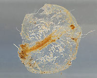 Midge (Chironomidae) Larva with Midge (Tanypodinae) Larvae Well. This is weird and I wish I had better photos, but this was super hard to photograph. <br />
<br />
What you are looking at is a gelatinous blob with tiny midge eggs (Tanypodinae). In the center of the blob is a large Chironomid larva that appeared to have gotten inside the blob somehow and made itself a tunnel. It was eating the goo or the eggs, I'm not sure. <br />
<br />
***This photo was taken 24 hours after collection. The tiny midge eggs had hatched and the large larva had grown a bit. The gelatinous matrix was beginning to break down.<br />
<br />
Habitat: Collected in a pond and photographed at home.<br />
<br />
Video on Day 1: https://vimeo.com/430465270<br />
<br />
Video after 48 hours: https://vimeo.com/430466114<br />
<br />
Photo from Day 1 (Day of Collection):<br />
https://www.jungledragon.com/image/95894/midge_chironomidae_larva_with_midge_tanypodinae_eggs.html<br />
<br />
Photo from 48 hours after collection:<br />
https://www.jungledragon.com/image/95896/midge_chironomidae_larva_with_midge_tanypodinae_larvae.html Geotagged,Spring,United States