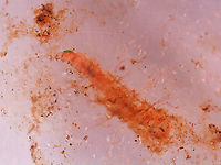 Midge (Chironomidae) Larva with Midge (Tanypodinae) Larvae Well. This is weird and I wish I had better photos, but this was super hard to photograph. <br />
<br />
What you are looking at is a gelatinous blob with tiny midge eggs (Tanypodinae). In the center of the blob is a large Chironomid larva that appeared to have gotten inside the blob somehow and made itself a tunnel. It was eating the goo or the eggs, I'm not sure. <br />
<br />
***This photo was taken 48 hours after collection. The tiny midge larva had grown and the gelatinous matrix was really a mess.<br />
<br />
Habitat: Collected in a pond and photographed at home.<br />
<br />
Video on Day 1: https://vimeo.com/430465270<br />
<br />
Video after 48 hours: https://vimeo.com/430466114<br />
<br />
Photo from Day 1 (Day of Collection):<br />
https://www.jungledragon.com/image/95894/midge_chironomidae_larva_with_midge_tanypodinae_eggs.html<br />
<br />
Photo from 24 hours after collection:<br />
https://www.jungledragon.com/image/95895/midge_chironomidae_larva_with_midge_tanypodinae_larvae.html<br />
<br />
<br />
 Geotagged,United States