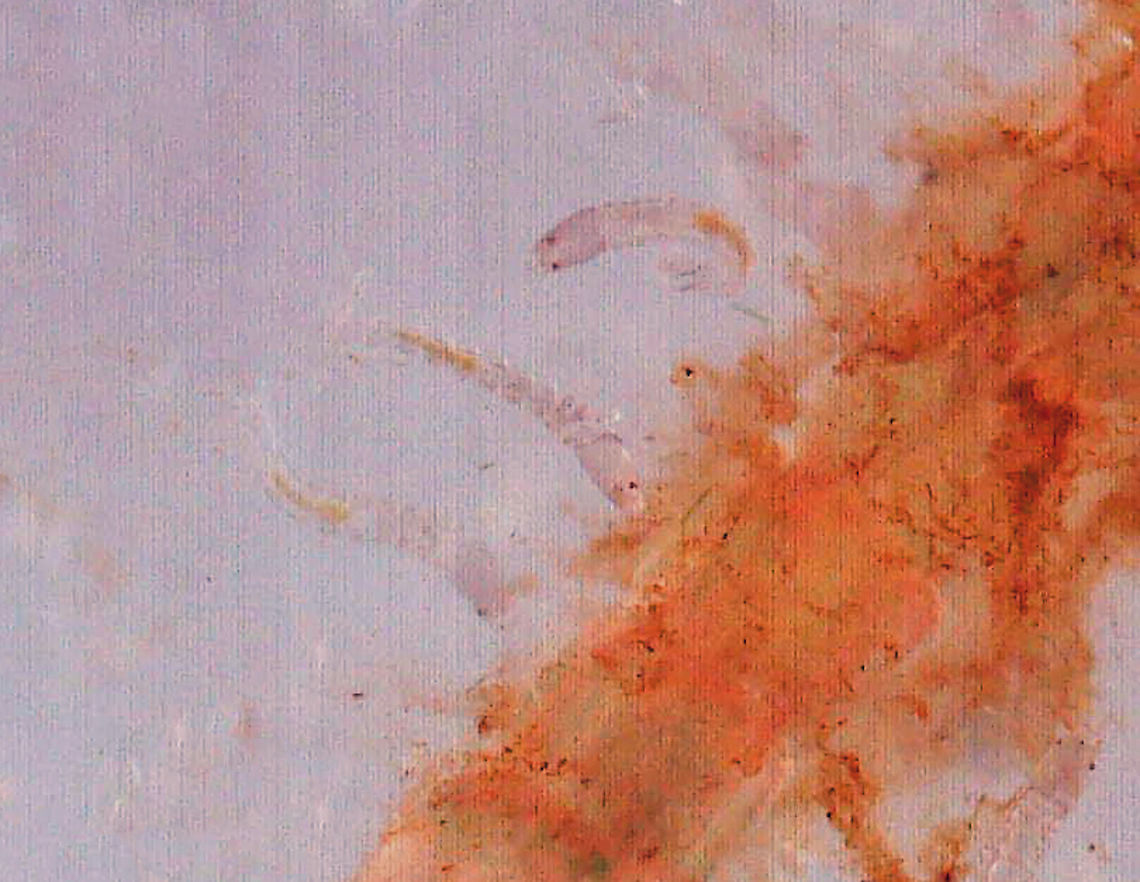 Midge (Tanypodinae) Larvae - 48 hours after hatching I will try to get more, i.e. better, photos tomorrow using a black stage. These little larvae look like tiny, translucent specks.<br />
<br />
These are the tiny larvae associated with this spotting:<br />
<figure class="photo"><a href="https://www.jungledragon.com/image/95896/midge_chironomidae_larva_with_midge_tanypodinae_larvae.html" title="Midge (Chironomidae) Larva with Midge (Tanypodinae) Larvae"><img src="https://s3.amazonaws.com/media.jungledragon.com/images/3232/95896_thumb.jpg?AWSAccessKeyId=05GMT0V3GWVNE7GGM1R2&Expires=1759968010&Signature=APJpPp1kh9ddrilxwU5rHs5J%2F1A%3D" width="200" height="152" alt="Midge (Chironomidae) Larva with Midge (Tanypodinae) Larvae Well. This is weird and I wish I had better photos, but this was super hard to photograph. <br />
<br />
What you are looking at is a gelatinous blob with tiny midge eggs (Tanypodinae). In the center of the blob is a large Chironomid larva that appeared to have gotten inside the blob somehow and made itself a tunnel. It was eating the goo or the eggs, I&#039;m not sure. <br />
<br />
***This photo was taken 48 hours after collection. The tiny midge larva had grown and the gelatinous matrix was really a mess.<br />
<br />
Habitat: Collected in a pond and photographed at home.<br />
<br />
Video on Day 1: https://vimeo.com/430465270<br />
<br />
Video after 48 hours: https://vimeo.com/430466114<br />
<br />
Photo from Day 1 (Day of Collection):<br />
https://www.jungledragon.com/image/95894/midge_chironomidae_larva_with_midge_tanypodinae_eggs.html<br />
<br />
Photo from 24 hours after collection:<br />
https://www.jungledragon.com/image/95895/midge_chironomidae_larva_with_midge_tanypodinae_larvae.html<br />
<br />
<br />
 Geotagged,United States" /></a></figure><br />
<br />
24 hours earlier, they looked like this:<br />
<figure class="photo"><a href="https://www.jungledragon.com/image/95897/midge_tanypodinae_larvae_-_24_hours_after_hatching.html" title="Midge (Tanypodinae) Larvae - 24 hours after hatching"><img src="https://s3.amazonaws.com/media.jungledragon.com/images/3232/95897_thumb.jpg?AWSAccessKeyId=05GMT0V3GWVNE7GGM1R2&Expires=1759968010&Signature=gtu4ma2cHseBDKLGQHvxaMqKBJI%3D" width="200" height="148" alt="Midge (Tanypodinae) Larvae - 24 hours after hatching These are the tiny larvae associated with this spotting:<br />
https://www.jungledragon.com/image/95896/midge_chironomidae_larva_with_midge_tanypodinae_larvae.html<br />
<br />
Larvae after 48 hours:<br />
https://www.jungledragon.com/image/95898/midge_tanypodinae_larvae_-_48_hours_after_hatching.html Geotagged,Spring,Tanypodinae,United States,larvae,midge,midge larvae" /></a></figure><br />
 Geotagged,United States