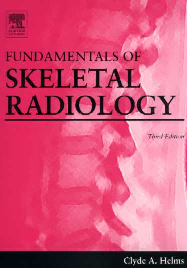 Fundamentals of Skeletal Radiology Cover Image