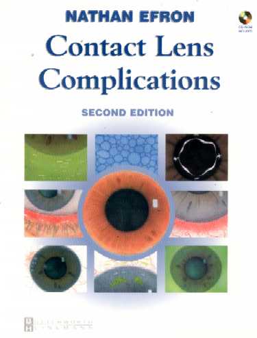 Contact Lens Complications. Text with CD-ROM for Macintosh and Windows Cover Image