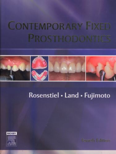 Contemporary Fixed Prosthodontics Cover Image