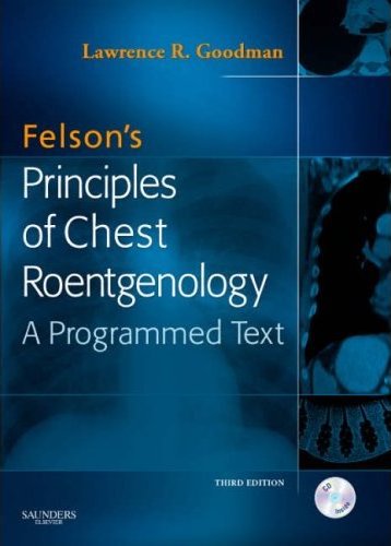 Felsons Principles of Chest Roentgenology. Text with CD-Rom for Windows and Macintosh Cover Image