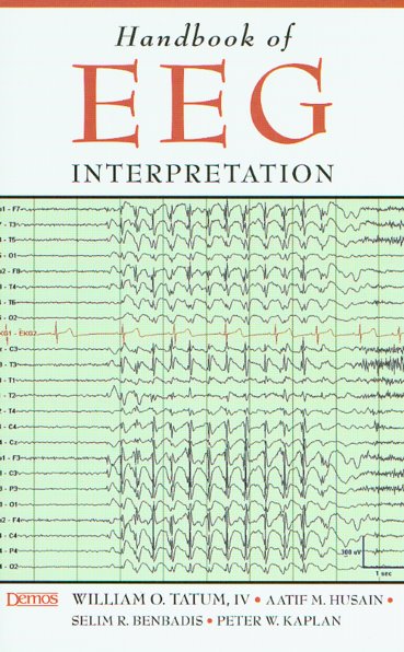 Handbook of EEG Interpretation Cover Image