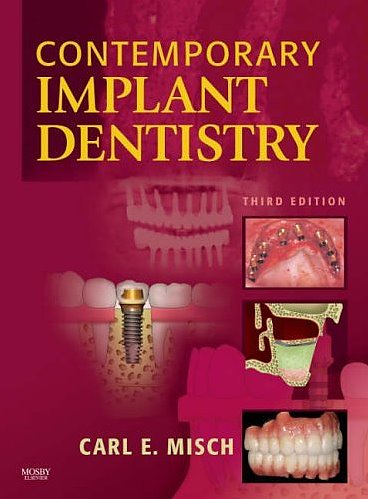 Contemporary Implant Dentistry Cover Image