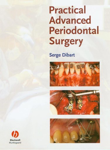 Practical Advanced Periodontal Surgery Cover Image