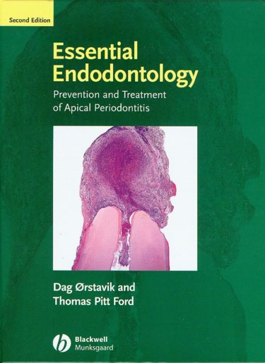 Essential Endodontology: Prevention and Treatment of Apical Periodontitis Cover Image