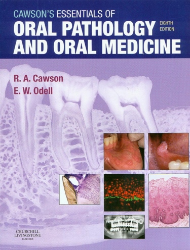 Cawsons Essentials of Oral Pathology and Oral Medicine Cover Image