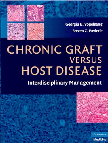 Chronic Graft Versus Host Disease. Interdisciplinary Management Cover Image