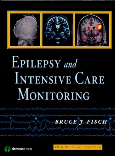 Epilepsy and Intensive Care Monitoring: Principles and Practice Cover Image
