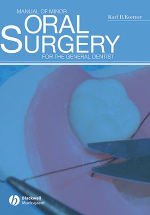 Manual of Minor Oral Surgery for the General Dentist Cover Image