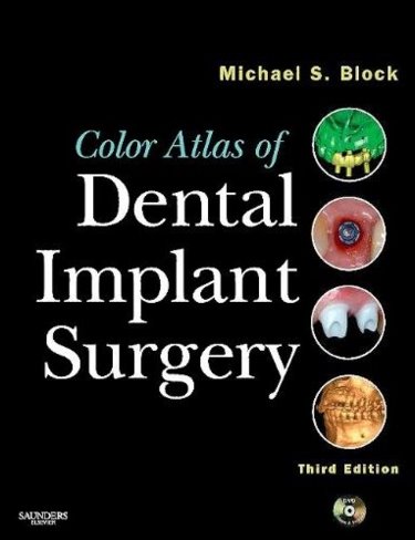 Color Atlas of Dental Implant Surgery. Text with DVD Cover Image