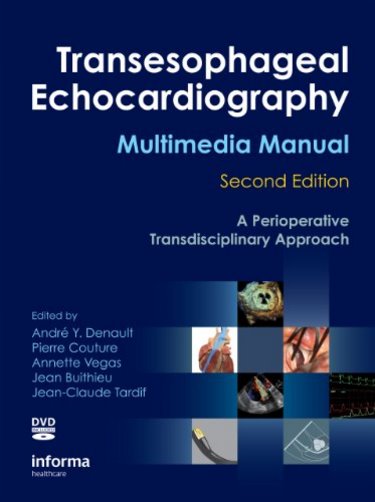 Transesophageal Echocardiography Multimedia Manual: A Perioperative Transdisciplinary Approach Cover Image