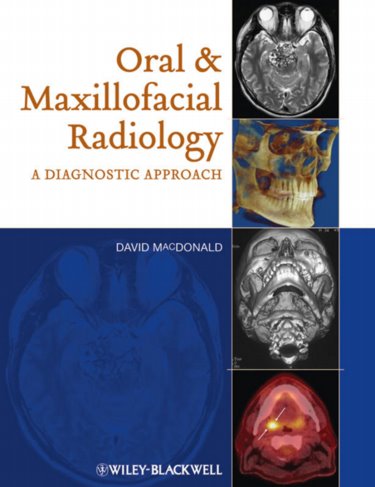 Oral and Maxillofacial Radiology: A Diagnostic Approach Cover Image