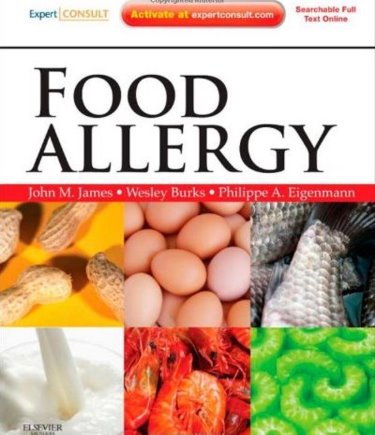 Food Allergy. Text with Internet Access Code for Expert Consult Edition Cover Image