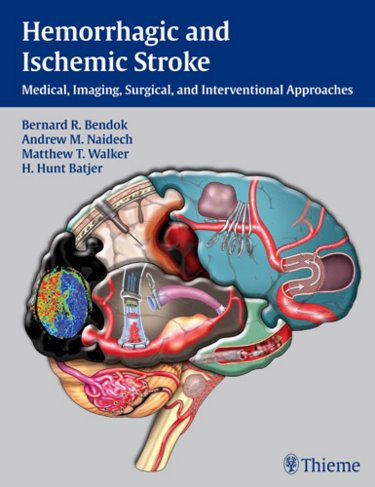 Hemorrhagic and Ischemic Stroke: Medical, Imaging, Surgical and Interventional Approaches. Text with Internet Access Code for Surgical Videos Online Cover Image