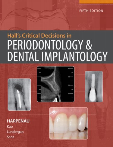 Halls Critical Decisions in Periodontology and Dental Implantology Cover Image