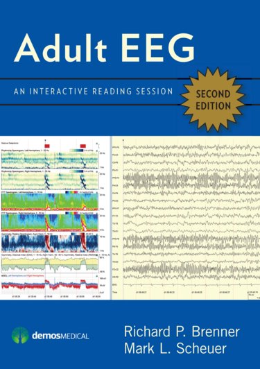Adult EEG: An Interactive Reading Session on DVD-ROM for Windows and Macintosh Cover Image