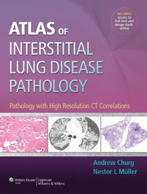 Atlas of Interstitial Lung Disease Pathology: Pathology with High Resolution CT Correlations. Text with Access Code Cover Image