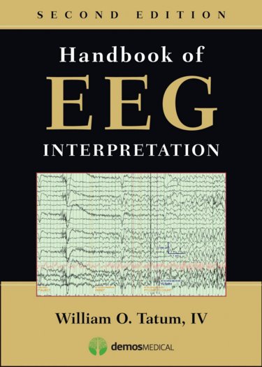 Handbook of EEG Interpretation Cover Image
