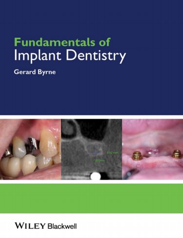 Fundamentals of Implant Dentistry Cover Image