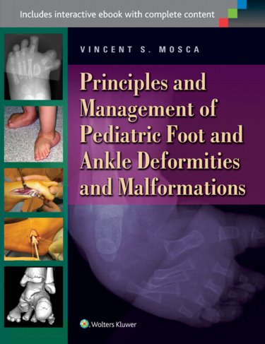 Principles and Management of Pediatric Foot and Ankle Deformities and Malformations. Text with Access Code Cover Image