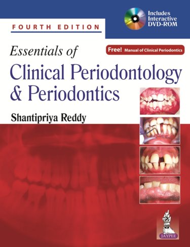 Essentials of Clinical Periodontology and Periodontics. Text with DVD-ROM for Windows & Macintosh. Includes Free Manual Manual of Clinical Periodontics Cover Image