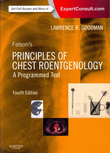 Felsons Principles of Chest Roentgenology: A Programmed Text. Text with Access Code (Expert Consult) Cover Image