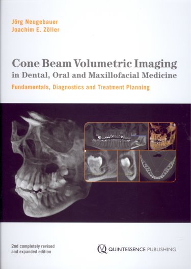 Cone Beam Volumetric Imaging in Dental, Oral and Maxillofacial Medicine: Fundamentals, Diagnostics and Treatment Planning. Text with DVD Cover Image