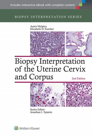 Biopsy Interpretation of the Uterine Cervix and Corpus. Text with Access Code Cover Image