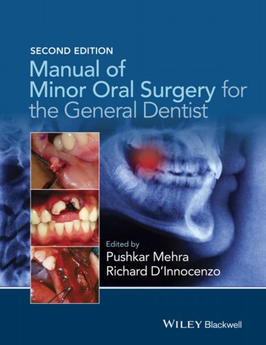 Manual of Minor Oral Surgery for the General Dentist Cover Image