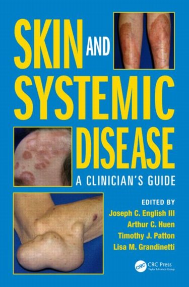 Skin and Systemic Disease: A Clinicians Guide Cover Image