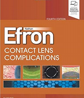 Contact Lens Complications. Text with Internet Access Code for Expert Consult Edition Cover Image