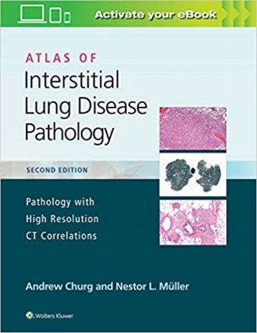 Atlas of Interstitial Lung Disease Pathology: Pathology with High Resolution CT Correlations. Text with Access Code Cover Image