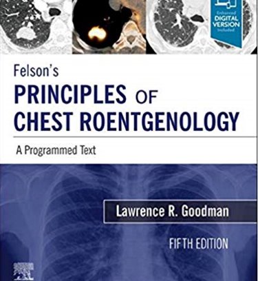 Felsons Principles of Chest Roentgenology: A Programmed Text. Text with Access Code (Expert Consult) Cover Image