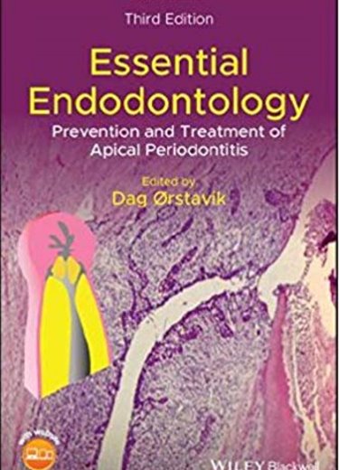 Essential Endodontology: Prevention and Treatment of Apical Periodontitis Cover Image