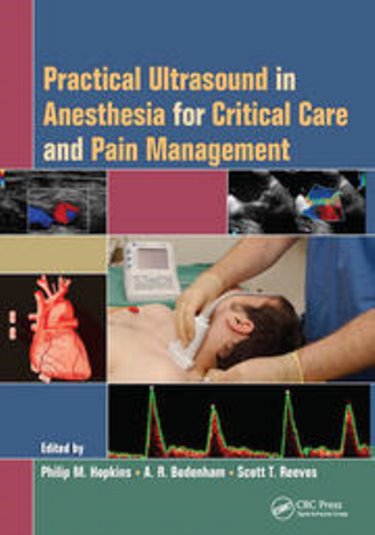 Practical Ultrasound in Anesthesia for Critical Care and Pain Management Cover Image